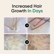 Ultimate Hair Boost