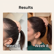 Ultimate Hair Boost