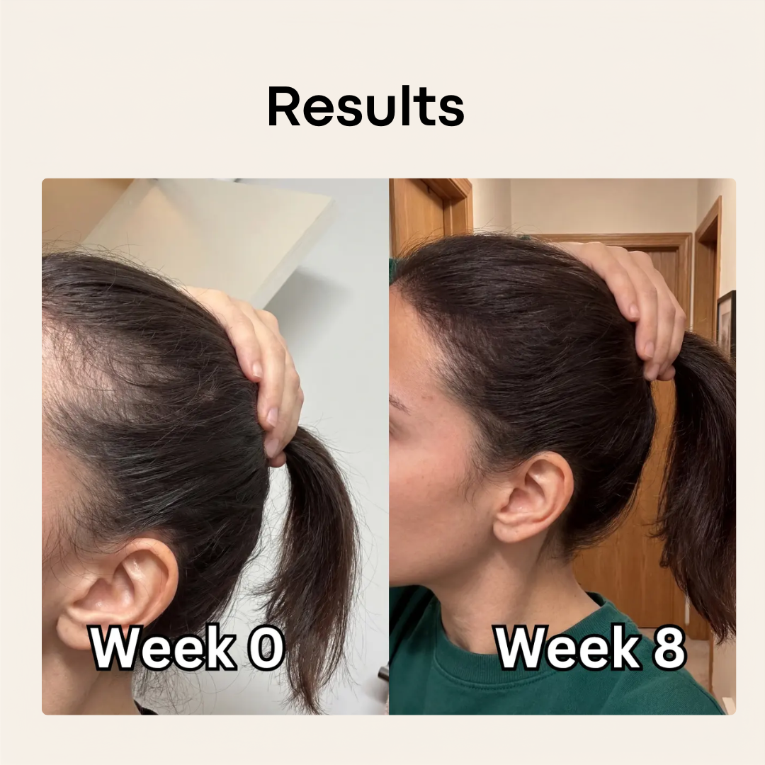 Ultimate Hair Boost