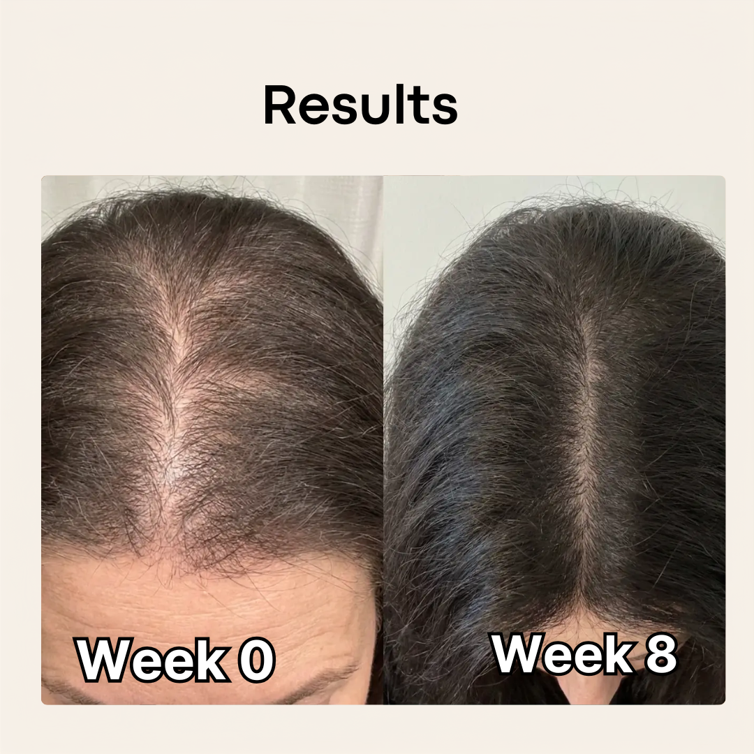 Ultimate Hair Boost
